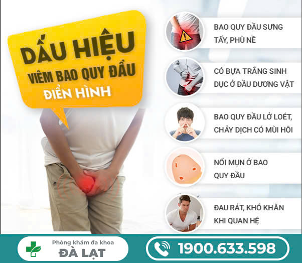 Hình ảnh minh họa